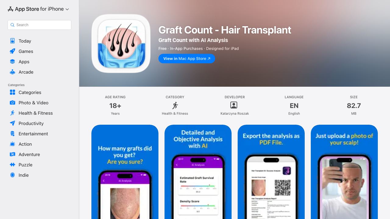 Hair Transplant AI Success 网站截图